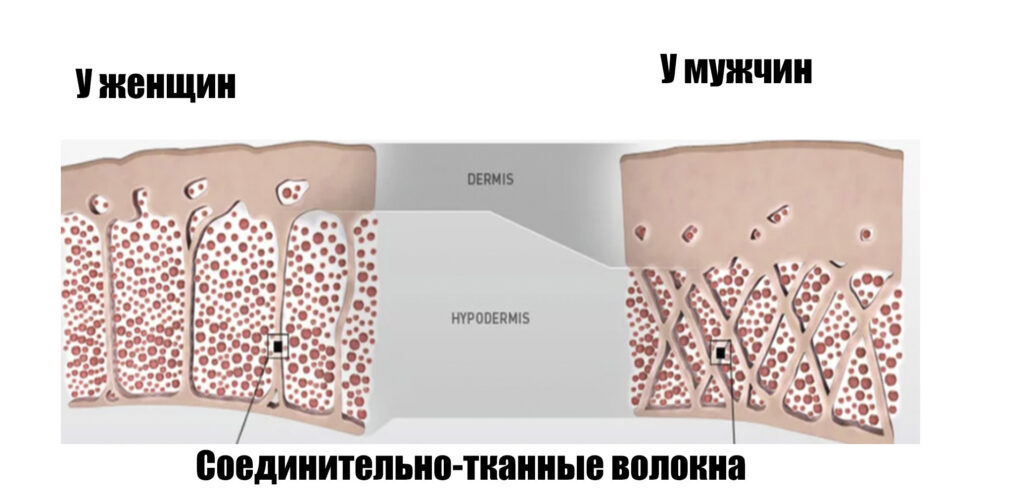 Строение подкожной жировой ткани у мужчин и женщин